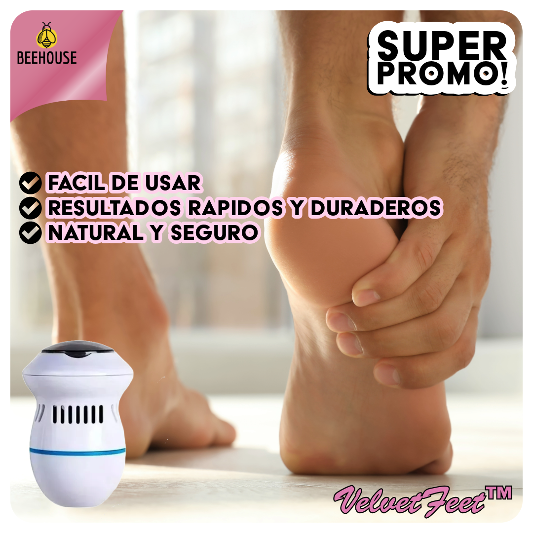 Removedor de Callos VelvetFeet™ - Pies perfectos, sin esfuerzo